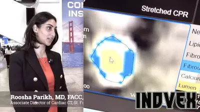 Advancements in Coverage for AI-Driven Plaque Assessments