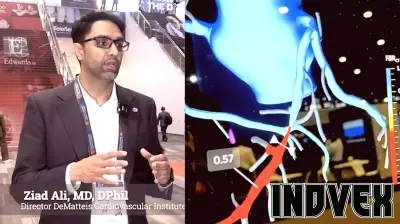 CCTA becoming an essential tool for interventional cardiologists